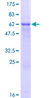 12.5% SDS-PAGE Stained with Coomassie Blue.
